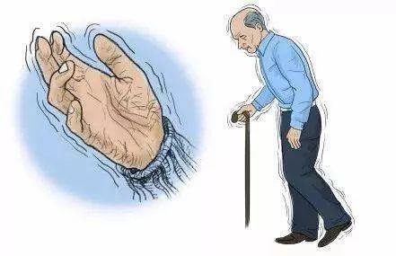 帕金森病的誤區(qū)，你知道嗎？